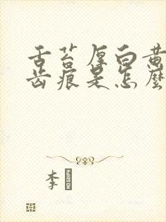 舌苔厚白黄腻有齿痕是怎么回事