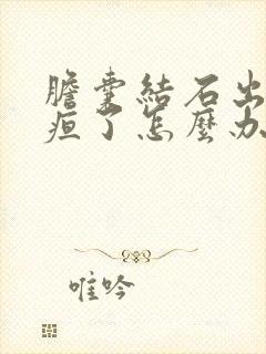 胆囊结石出现黄疸了怎么办