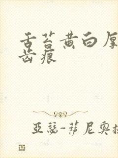 舌苔黄白厚腻有齿痕