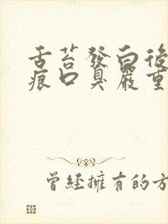 舌苔发白后有齿痕口臭严重