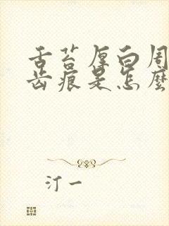 舌苔厚白周围有齿痕是怎么回事