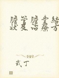 胆管胆囊结石症状及治疗方法