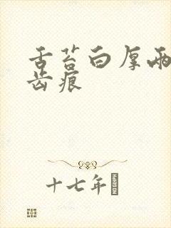 舌苔白厚两侧有齿痕