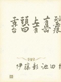 舌头上有裂纹舌苔白有齿痕