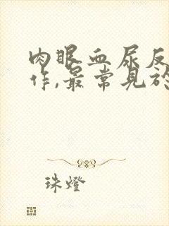 肉眼血尿反复发作,最常见于