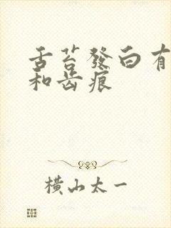 舌苔发白有裂纹和齿痕