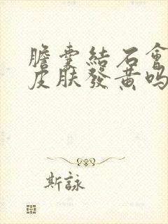 胆囊结石会导致皮肤发黄吗