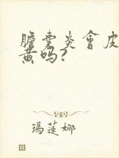 胆囊炎会皮肤发黄吗?