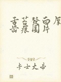 舌苔发白厚腻有齿痕图片