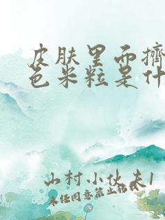 皮肤里面挤出白色米粒是什么东西