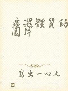 痰湿体质的舌苔图片