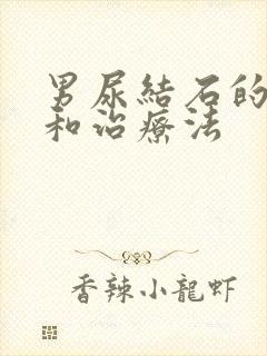 男尿结石的症状和治疗法