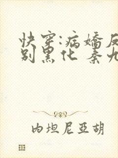 快穿:病娇反派别黑化 秦九歌