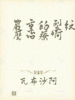 严重的裂纹舌怎么治疗啊