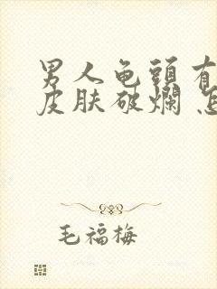 男人龟头有红点皮肤破烂 怎么回事