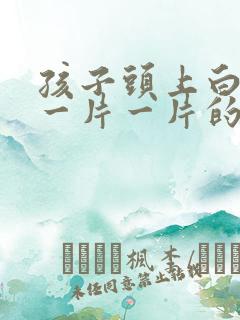 孩子头上白色的一片一片的