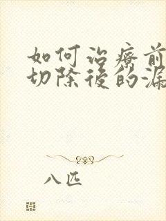 如何治疗前列腺切除后的漏尿