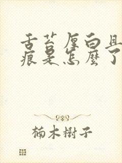 舌苔厚白且有齿痕是怎么了