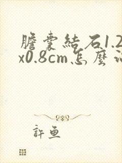 胆囊结石1.2x0.8cm怎么治疗