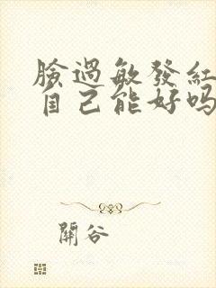 脸过敏发红发烫自己能好吗