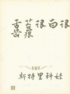 舌苔很白很厚有齿痕