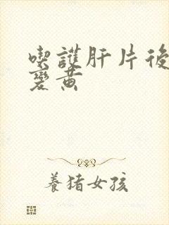 吃护肝片后尿液变黄