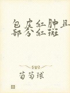 包皮红肿且龟头部分红斑