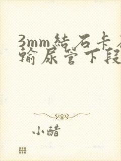 3mm结石卡在输尿管下段