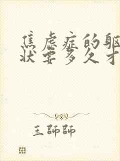 焦虑症的躯体症状要多久才能消失