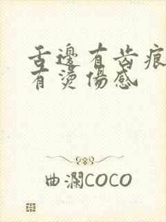 舌边有齿痕舌头有烫伤感