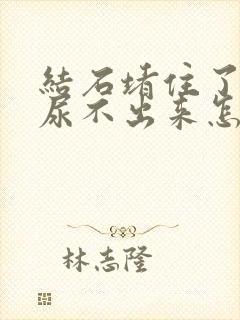 结石堵住了尿道尿不出来怎么办