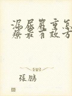 漏尿严重怎么治疗最有效方法