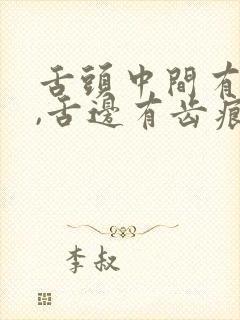 舌头中间有裂纹,舌边有齿痕