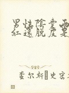 男性阴囊两边痒红还脱皮是怎么回事