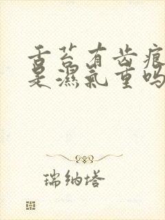 舌苔有齿痕一定是湿气重吗