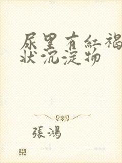 尿里有红褐色絮状沉淀物