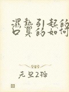 湿热引起的长期口臭的如何调理