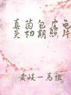 真菌包皮龟头发炎初期照片