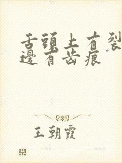 舌头上有裂纹舌边有齿痕