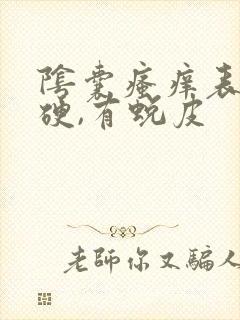 阴囊瘙痒表皮发硬,有蜕皮