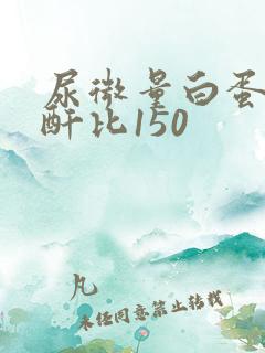 尿微量白蛋白肌酐比150