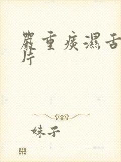 严重痰湿舌苔图片