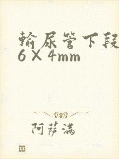 输尿管下段结石6×4mm