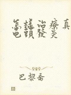 怎样治疗真菌性龟头发炎