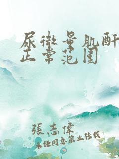 尿微量肌酐比值正常范围