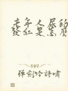 老年人尿的颜色发红是怎么回事