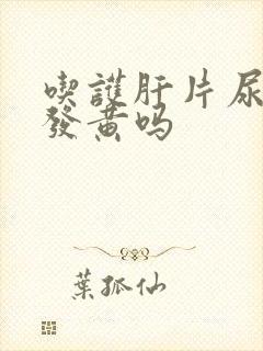 吃护肝片尿液会发黄吗