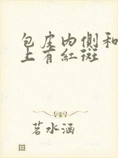 包皮内侧和龟头上有红斑