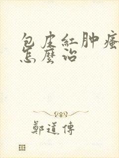 包皮红肿瘙痒该怎么治