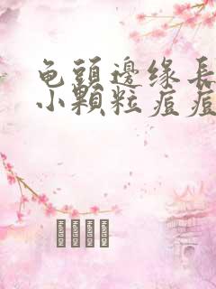 龟头边缘长一圈小颗粒痘痘